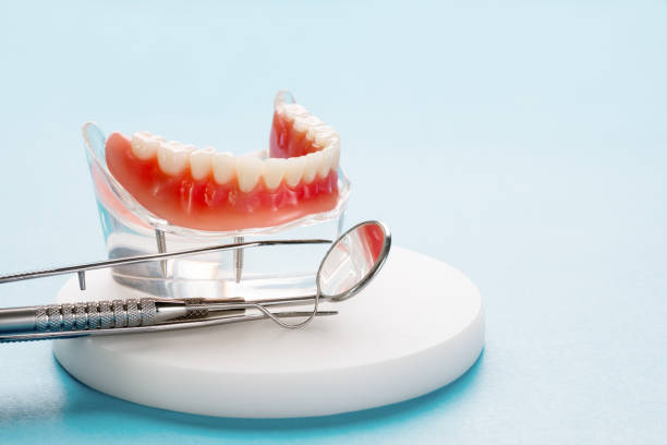 Full Mouth Reconstruction in Linganore, MD